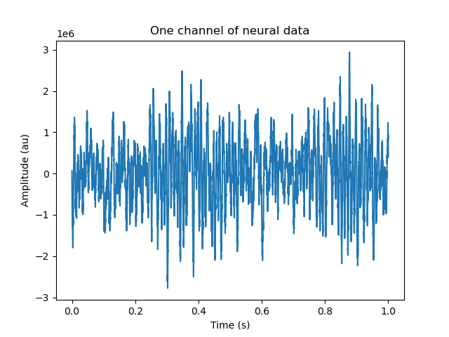One channel of neural data